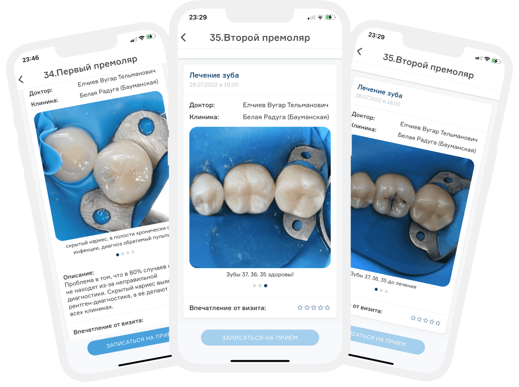 История лечения зубов в приложении